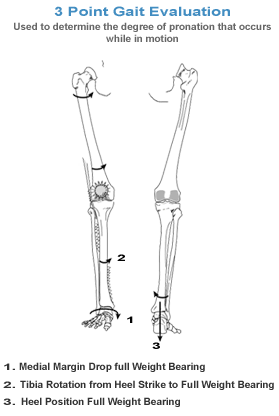 3 point gait analysis
